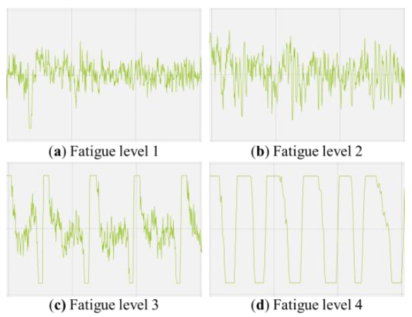 Electroencephalography-based Fatigue Assessment for Internet of Medical Things System